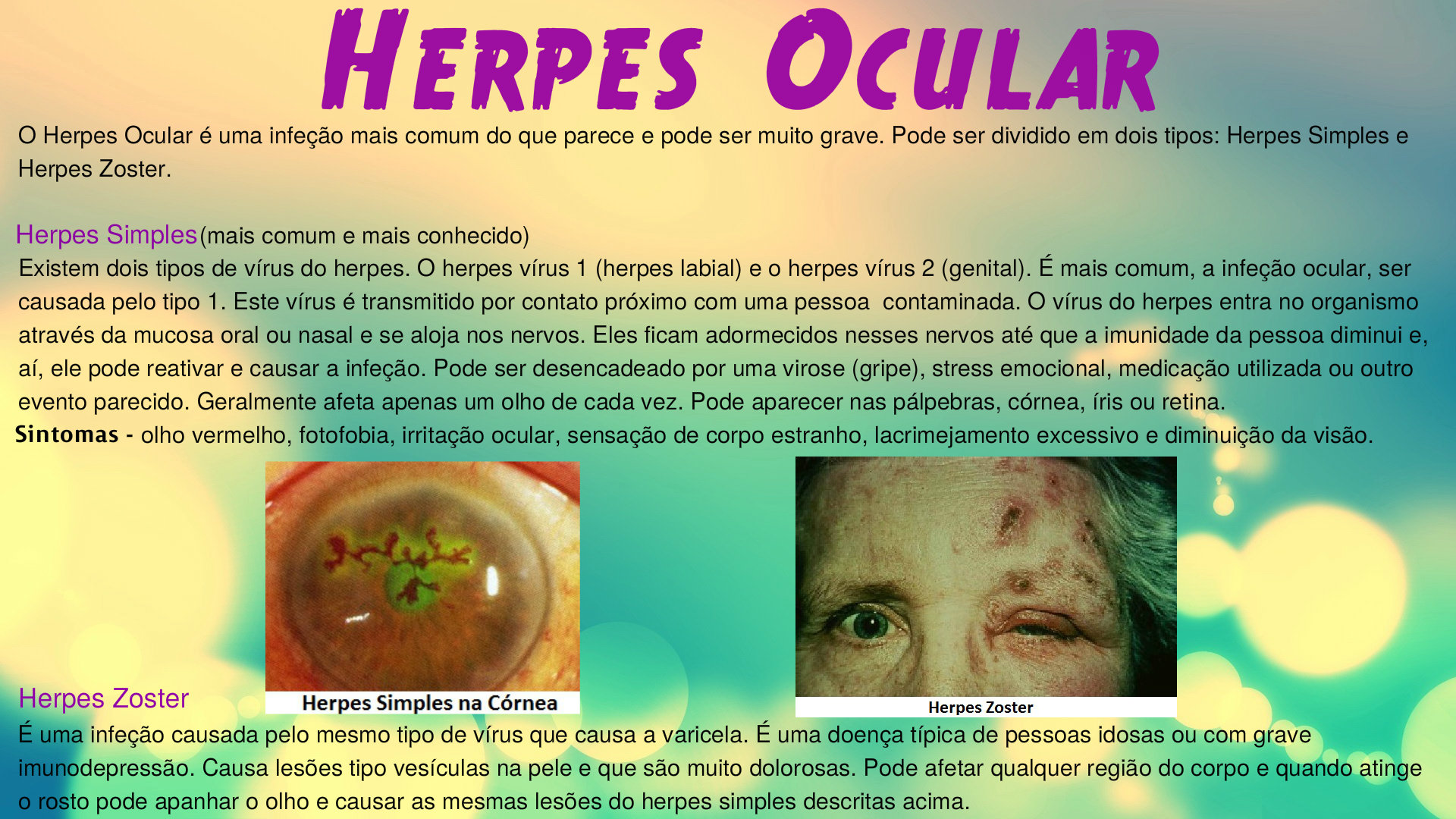 Herpes Ocular Grupo Flip ptica